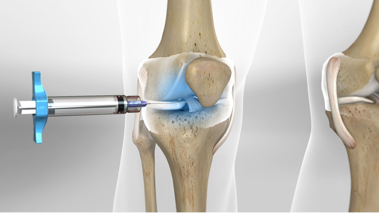 Images Intraarticular Injection