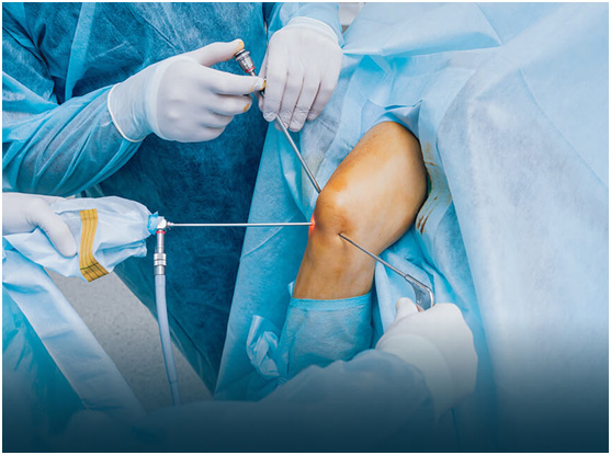 PCl Surgery Procedur